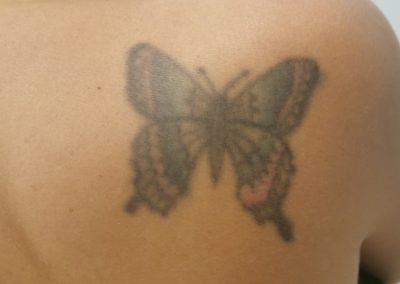 avant recouvrement papillon tattoo my st fulgent 85